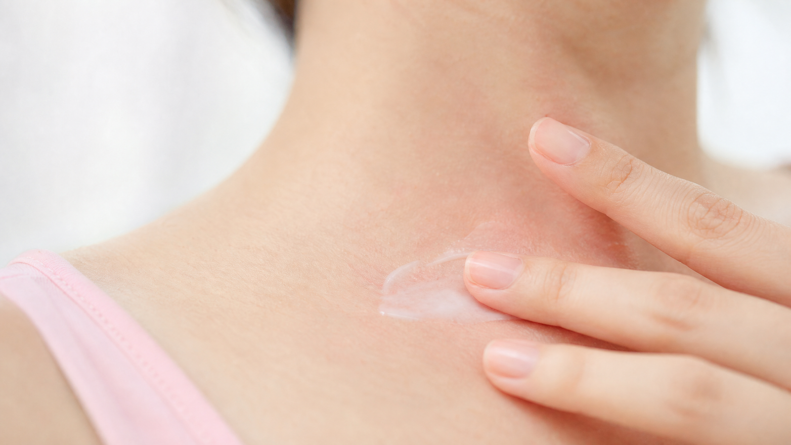 aloe vera para quemaduras con ampolla
